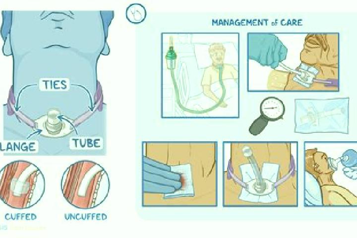 escort An Trach