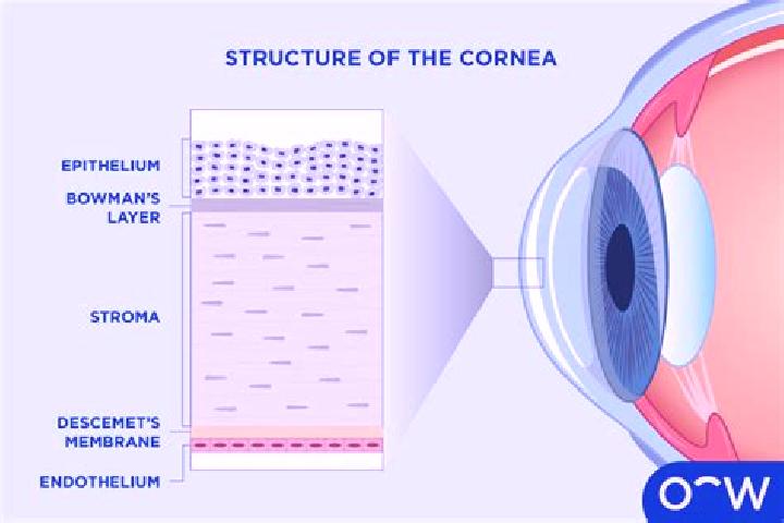 escort Cornea