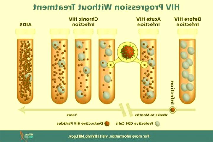 escort Hiv