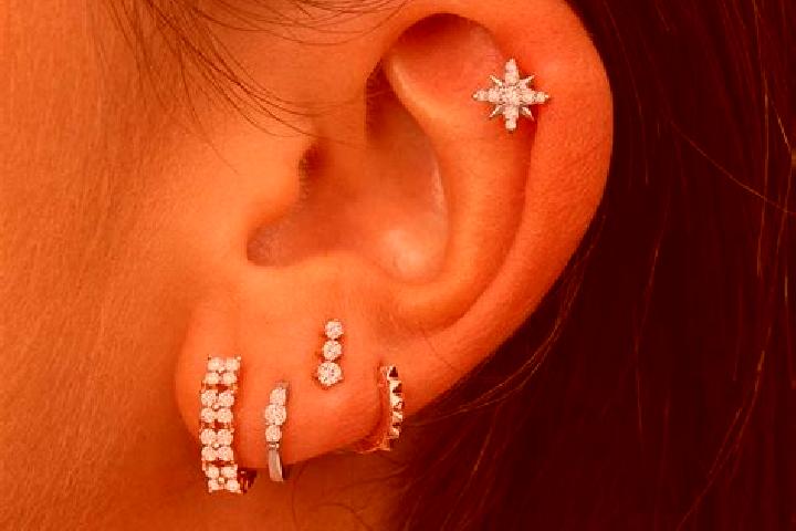 escort Oreja