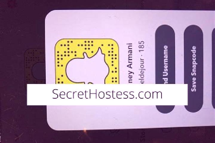 escort South Yarra