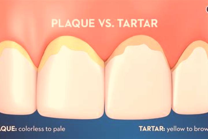 escort Tartar