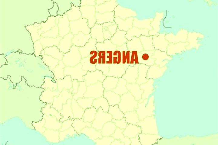 Escorts Angres, France — Local Companions