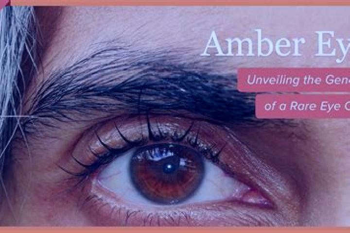 Nora, 25, a red amber-eyed indian companion based in Dannau. Offering Striptease, Erotic Massage, Tantra, Roleplay, Dinner Date. Available for incall and out...