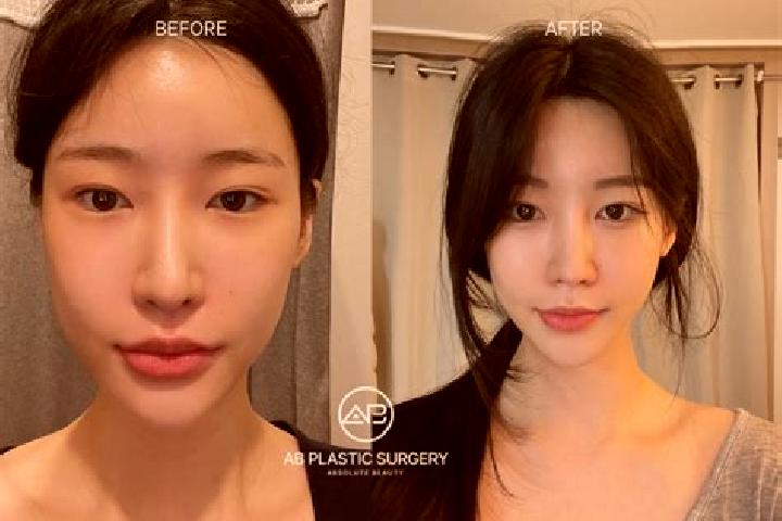 Sophia, 26 — Escort in Kowon-up, North Korea